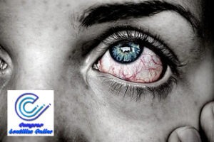 Conjuntivitis alergia en los ojos
